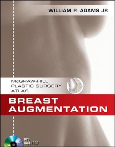 Breast Augmentation