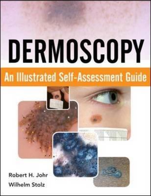 Dermoscopy