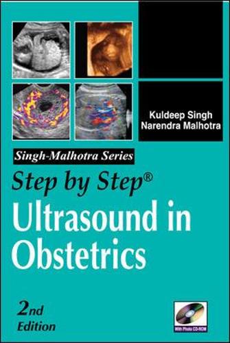 Step by Step Ultrasound in Obstetrics, Second Edition