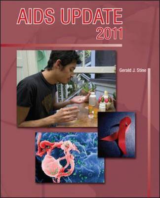 AIDS Update 2011