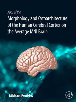 Atlas of the Morphology of the Human Cerebral Cortex on the Average MNI Brain