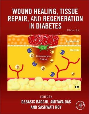 Wound Healing, Tissue Repair, and Regeneration in Diabetes