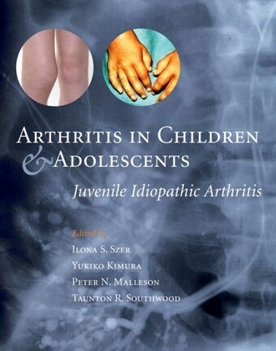 Arthritis in Children and Adolescents