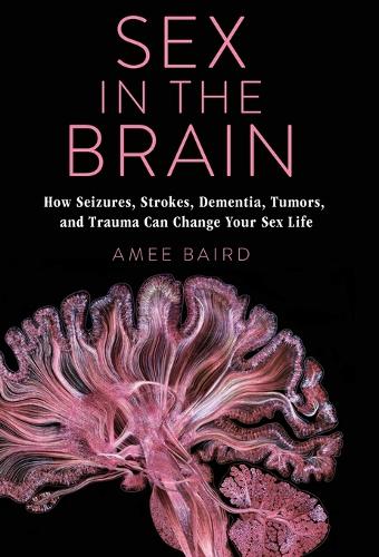 Sex in the Brain