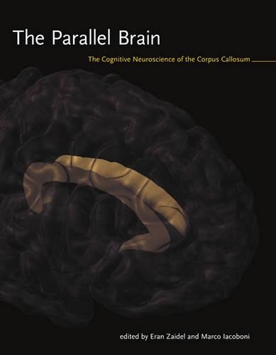 The Parallel Brain