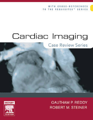 Cardiac Imaging