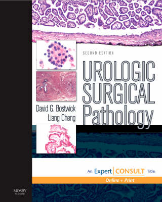 Urologic Surgical Pathology