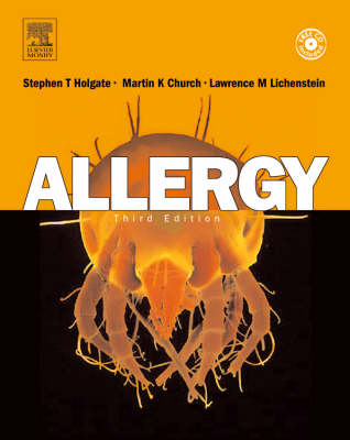 Allergy