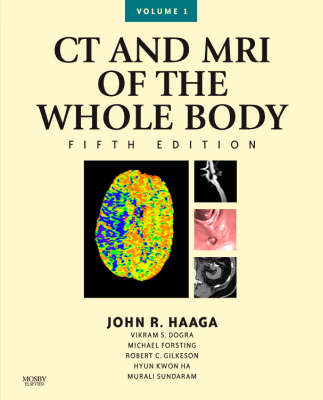 CT and MRI of the Whole Body