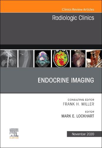 Endocrine Imaging, An Issue of Radiologic Clinics of North America Volume 58-6