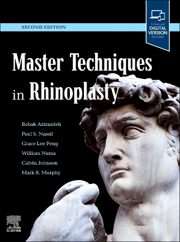 Master Techniques in Rhinoplasty