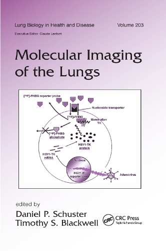 Molecular Imaging of the Lungs