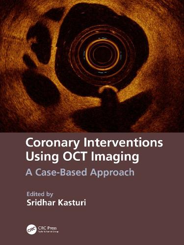 Coronary Interventions Using OCT Imaging