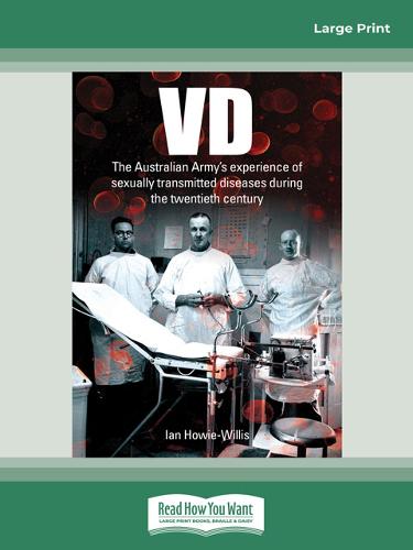 VD