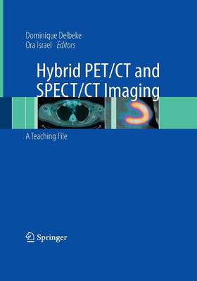 Hybrid PET/CT and SPECT/CT Imaging