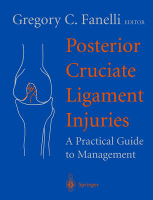 Posterior Cruciate Ligament Injuries
