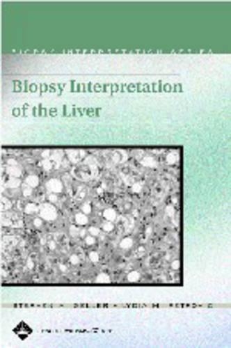 Biopsy Interpretation of the Liver
