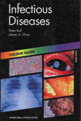 Infectious Diseases
