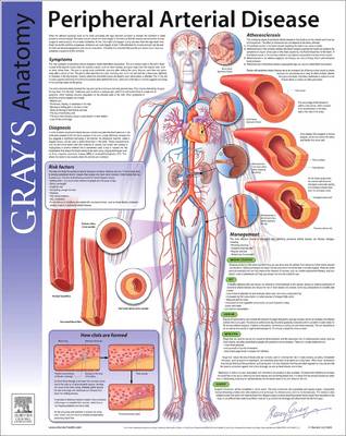 Peripheral Arterial Disease