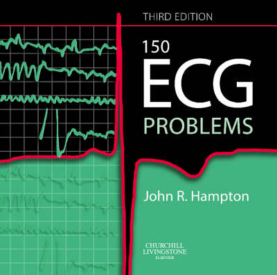 150 ECG Problems