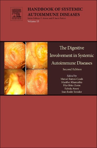 The Digestive Involvement in Systemic Autoimmune Diseases Volume 13