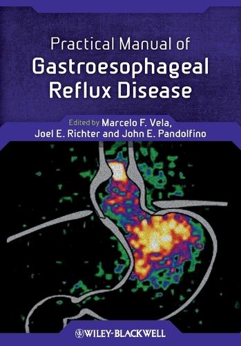 Practical Manual of Gastroesophageal Reflux Disease