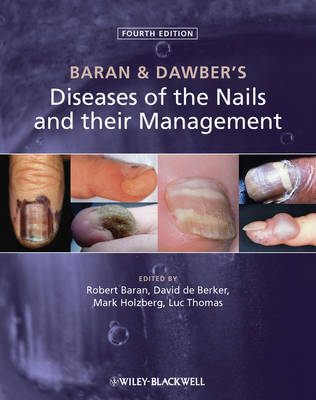 Baran and Dawber's Diseases of the Nails and their Management