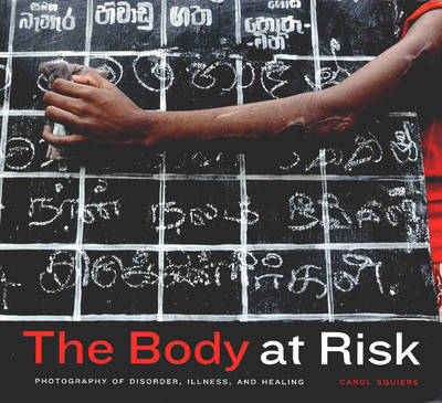 The Body at Risk