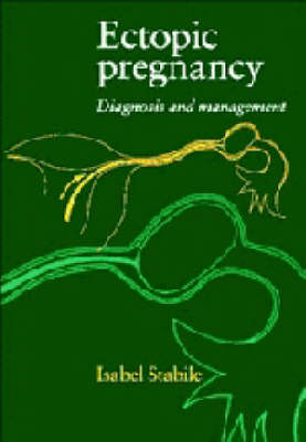 Ectopic Pregnancy