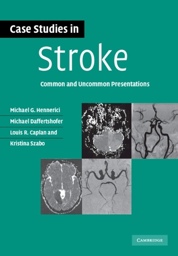 Case Studies in Stroke