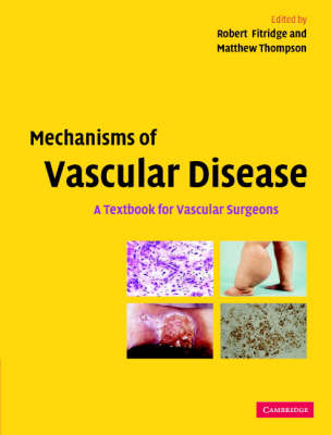 Mechanisms of Vascular Disease