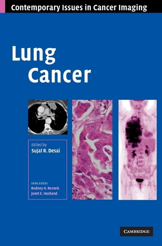Lung Cancer
