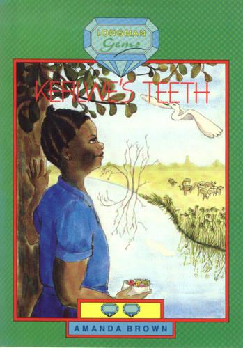 Kefilwe's Teeth