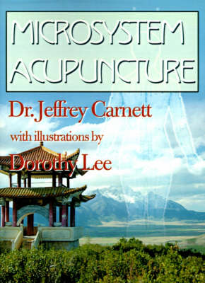 Microsystem Acupuncture