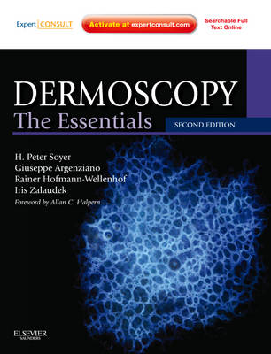 Dermoscopy