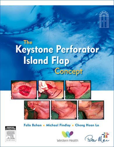 Design Concepts in Reconstructive Surgery