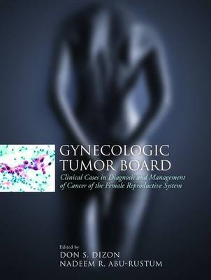 Gynecologic Tumor Board: Clinical Cases In Diagnosis And Management Of Cancer Of The Female Reproductive System