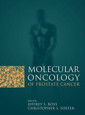 Molecular Oncology of Prostate Canc