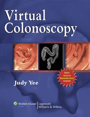 Virtual Colonoscopy