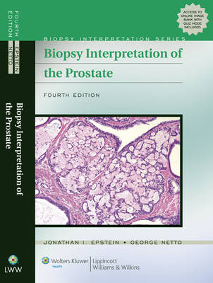 Biopsy Interpretation of the Prostate