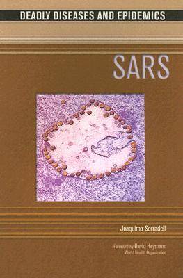 Sars