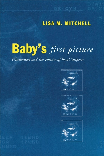 Baby's First Picture