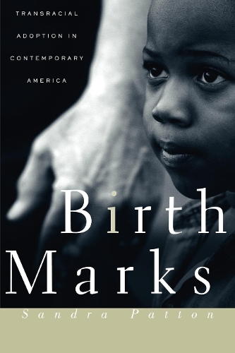 Birthmarks