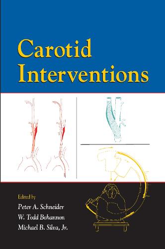 Carotid Interventions