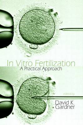 In Vitro Fertilization