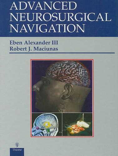 Advanced Neurosurgical Navigation