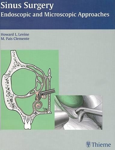 Sinus Surgery