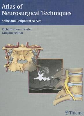 Atlas of Neurosurgical Techniques