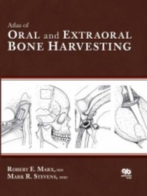 Atlas of Oral and Extraoral Bone Harvesting