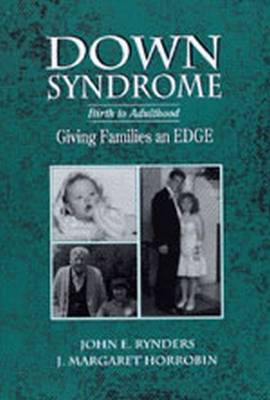 Down Syndrome